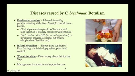 Clostridium botulinum (Botulism) - Microbiology Boot Camp - YouTube