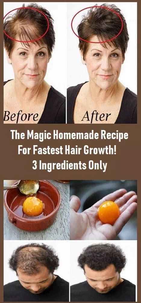 The Magic Homemade Recipe For Fastest Hair Growth 3 Ingredients Only