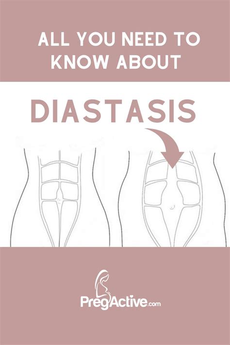 Exercises To Heal Diastasis Recti Abdominal Separation Recovery