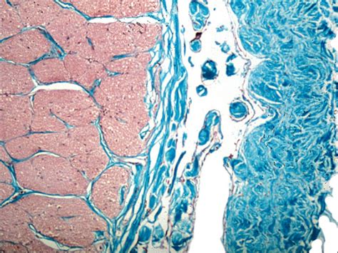 Moran Core Optic Nerve