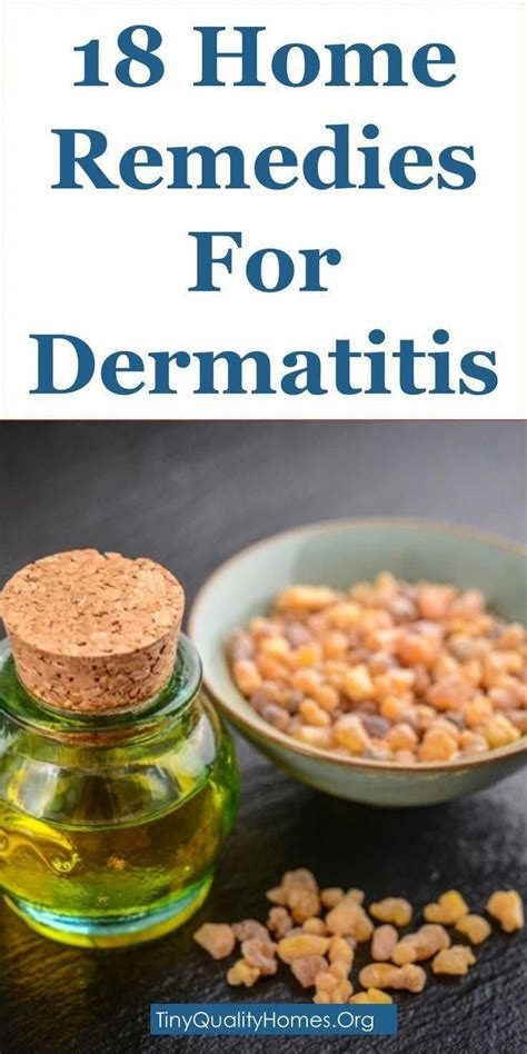 18 Effective Home Remedies For Dermatitis This Article Discusses Ideas