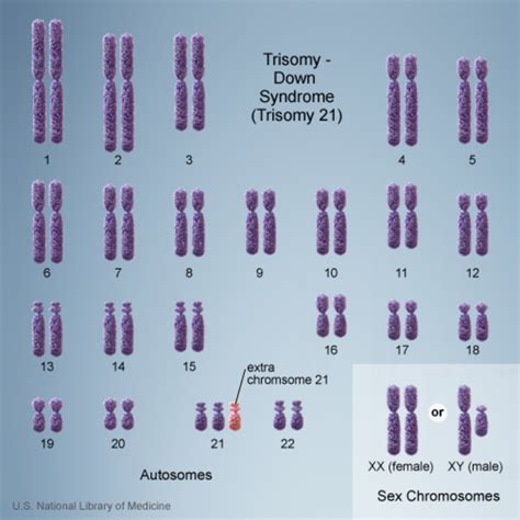 Alzheimers Disease Medlineplus Genetics