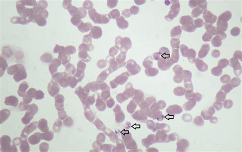 Babesia Sp Detected On A Blood Smear Using Light Microscopy Arrows