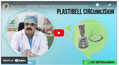 Plastibell Circumcision In Surat Elegance Clinic