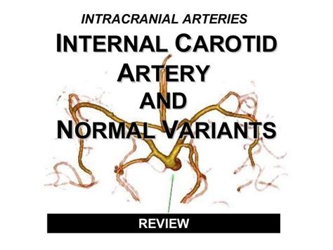 Intracranial Arteries