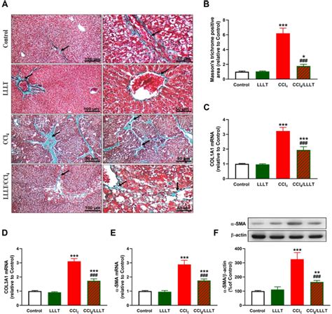 Lllt Attenuated Liver Fibrosis In Ccl Administered Rats A