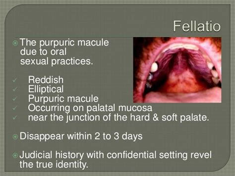 Red Lesion Of Oral Mucosa