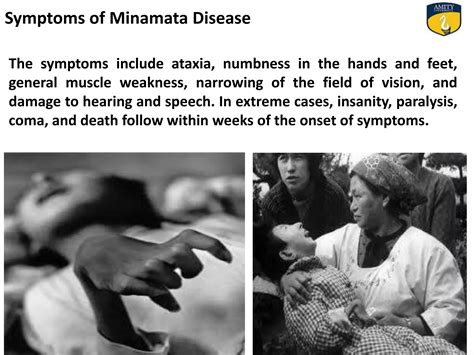 A Case Study On Minamata Disease By Ritu Chauhan Ppt