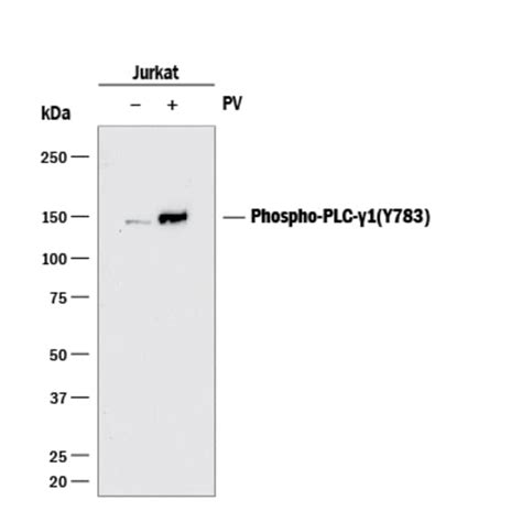 Human Phospho Plc Gamma 1 Y783 Antibody Randd Systems™ 100ug