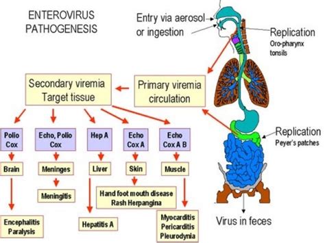 Coxsackie Virus