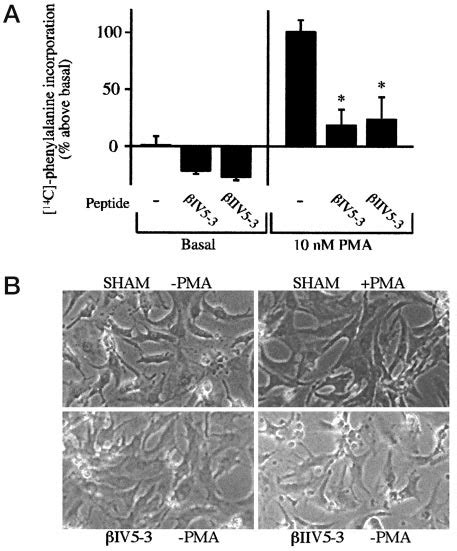 I And IIPKC Are Essential For PMA Induced Cardiac Myocyte Hypertrophy