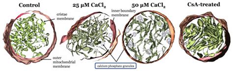 Biomolecules Free Full Text Calcium Overload And Mitochondrial