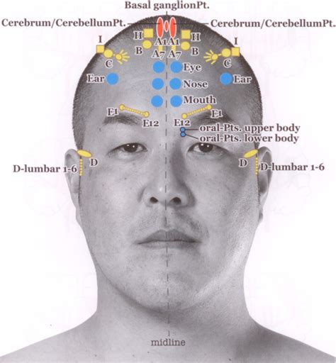 Schematic Representation Of The Frontal Ynsa Basic Points Needles Are