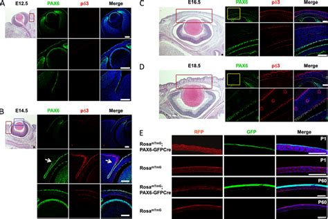 Pax And P Expression Patterns In Mouse Cornea At Different Embryonic