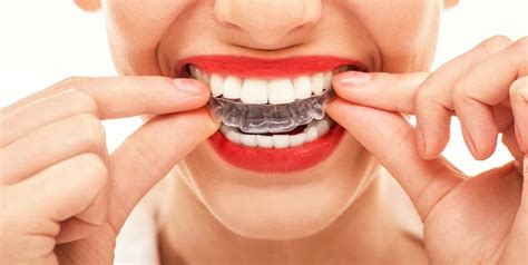 What Is Clear Aligner Therapy Know How To Get This Orthodontic Treatment By Expert Onlymyhealth