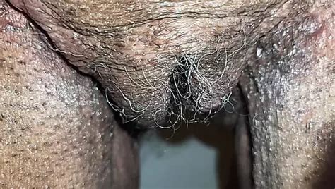 Black Pussy Prolapse XHamster