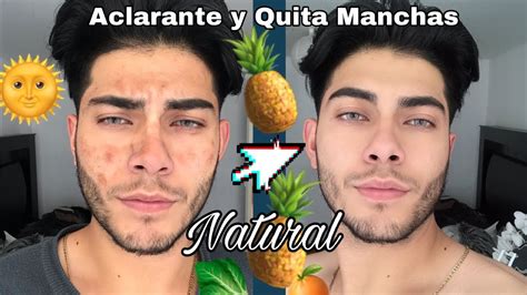 Cómo Quitar las Manchas de la Cara y Cuerpo Rápido y Natural YouTube