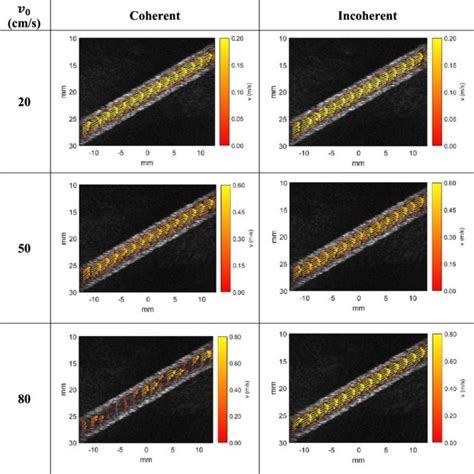 Ceus Li Rads Algorithm Image Reproduced With Permission From The Acr