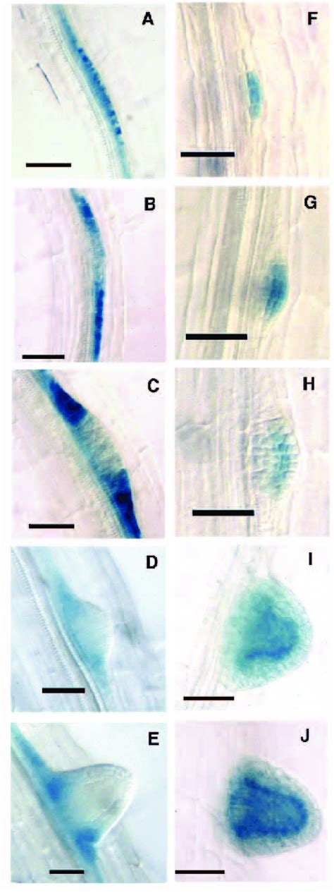 Gus Expression In Lateral Root Primordia Of Lrb10 And End199 Shown Are