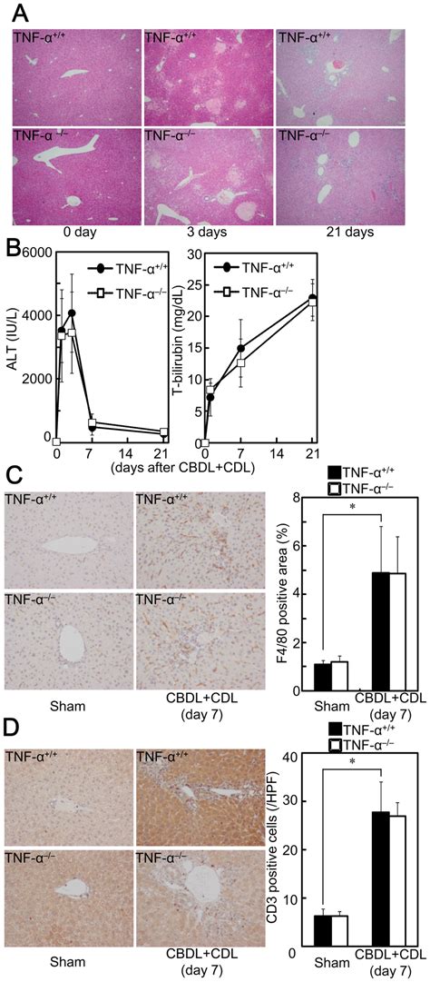 Tnf Deficiency Did Not Affect Cbdl Cdl Induced Liver Injury Tnf