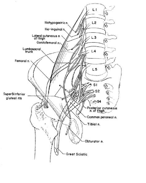 The Lumbosacral Plexus Table 1 Causes Of Lumbosacral Plexopathy