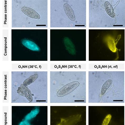 Fluorescence Microscopy And Phase Contrast Images Of Paramecium