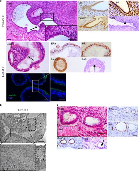 Ect O Reproduce The Primary Lesion In Vitro And In Vivo A Histological