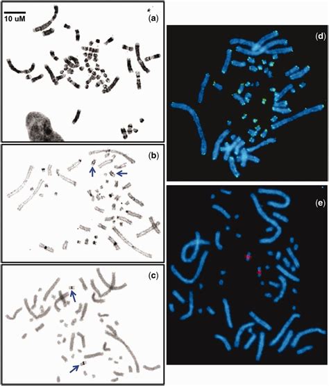 G Banded A C Banded B And Ag NOR Stained C Metaphase