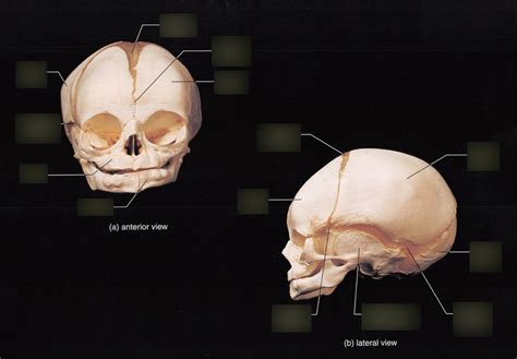 Fetal Skull Diagram Quizlet