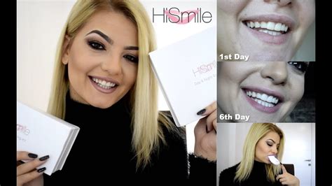 Does This Work Hismile Teeth Whitening Review Youtube