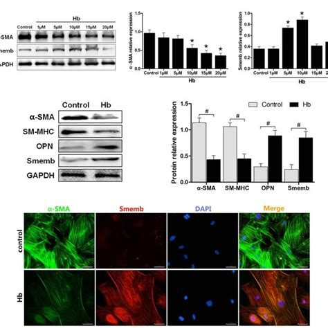 Ppar Mediated Cerebral Vsmc Phenotypic Switch Partially Through