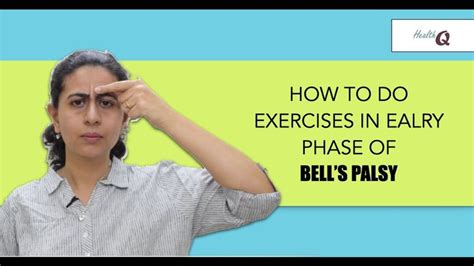 Facial Exercises In Early Phase Of Bell S Palsy Youtube Bells Palsy Facial Exercises Exercise