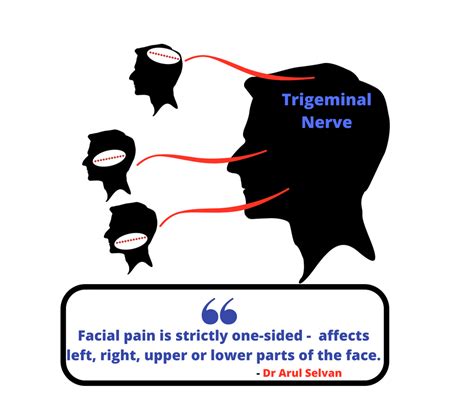 Trigeminal Nerve Numbness