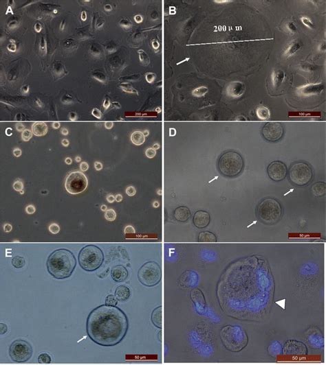 Larger Oocyte Like Structures Developed Spontaneously From Epithelial