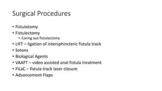 Fistula in Ano.pptx