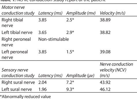 Table 1 From Acute Motor Sensory Axonal Neuropathy A Variant Of