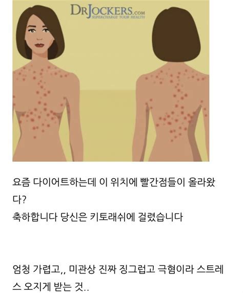 잡담 키토래쉬 겪어본사람 다이어터에게 최악임 인스티즈instiz 일상 카테고리