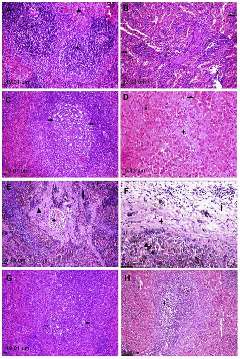 Histopathological Alterations In Splenic Sections Of Rats In Different