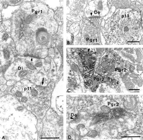 Examples Of Gaba Negative Axon Terminals In Emys Gld Labeled After Bda