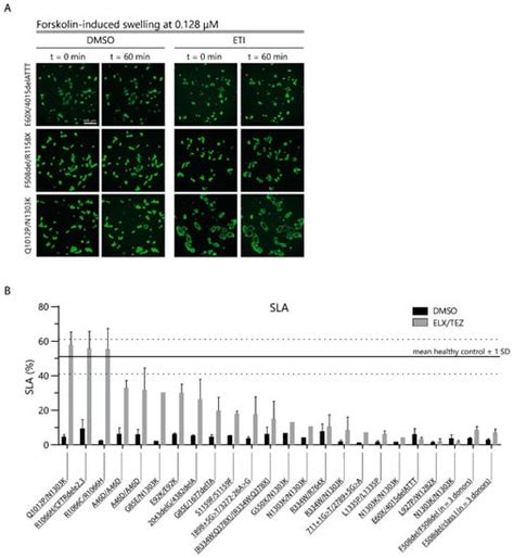 Ijms Free Full Text Cftr Function Restoration Upon Elexacaftor