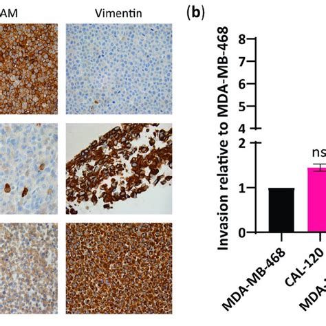 Basal B Breast Cancer Cell Lines CAL 120 And MDA MB 231 Showed