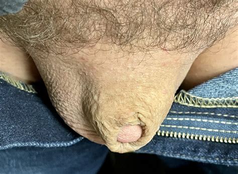 Tiny Cock Micro Cock 13 Nude Pics XHamster