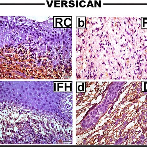 Representative Photomicrographs Of The Immunohistochemical Expressions