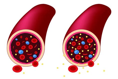 Lượng đường trong máu Mức độ glucose ảnh hưởng đến cơ thể của bạn như