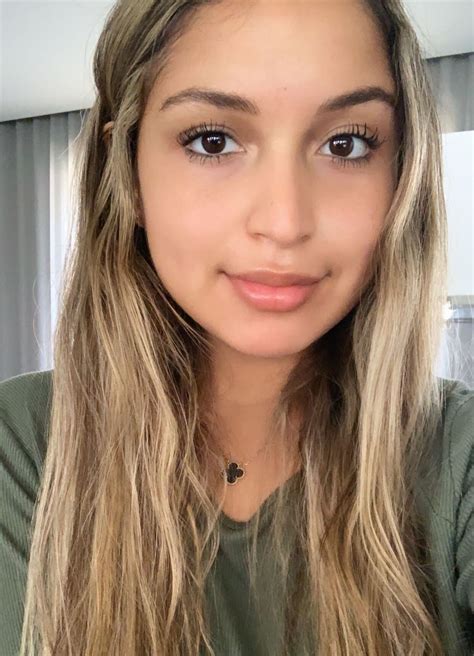 Everything You Need To Know About Lip Fillers: Lip Filler Before & After