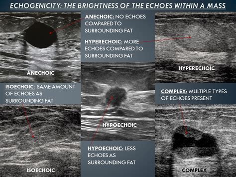 Essential Ultrasound Controls And How To Use Them Part 1 Sonography