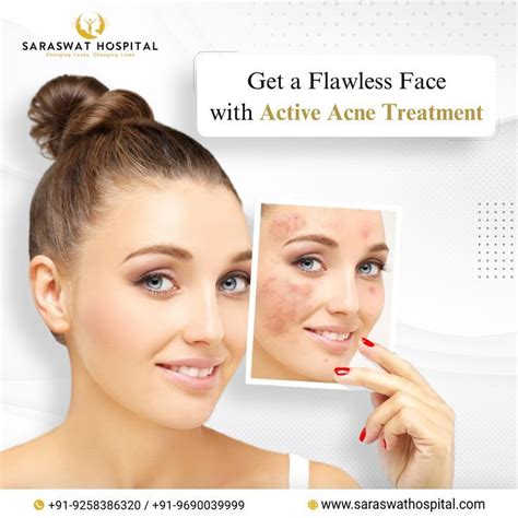 Acne Scar Treatment India Saraswat Hospital Agra Artofit