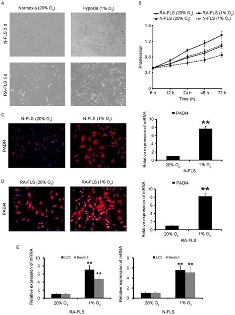 Hypoxia‑induced Autophagy Is Inhibited By Padi4 Knockdown Which