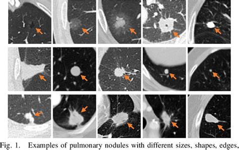 Figure 1 From SM RNet A Scale Aware Based Multiattention Guided