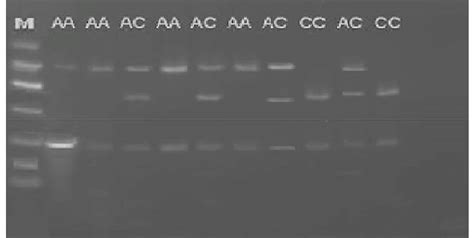 RFLP Analysis Of XPD Lys751Gln Rs13181 Lane M 50 Bp DNA Ladder AA